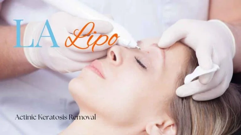 Woman receiving Actinic Keratosis Removal Treatment Greater London (Newham)