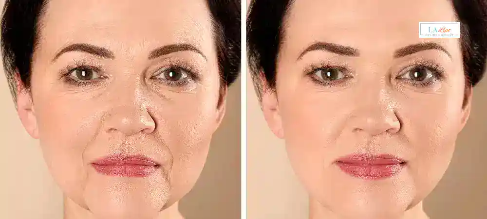 Why Aren’t My Skincare Products Making My Sagging Skin Look Firmer Greater London (Newham)?